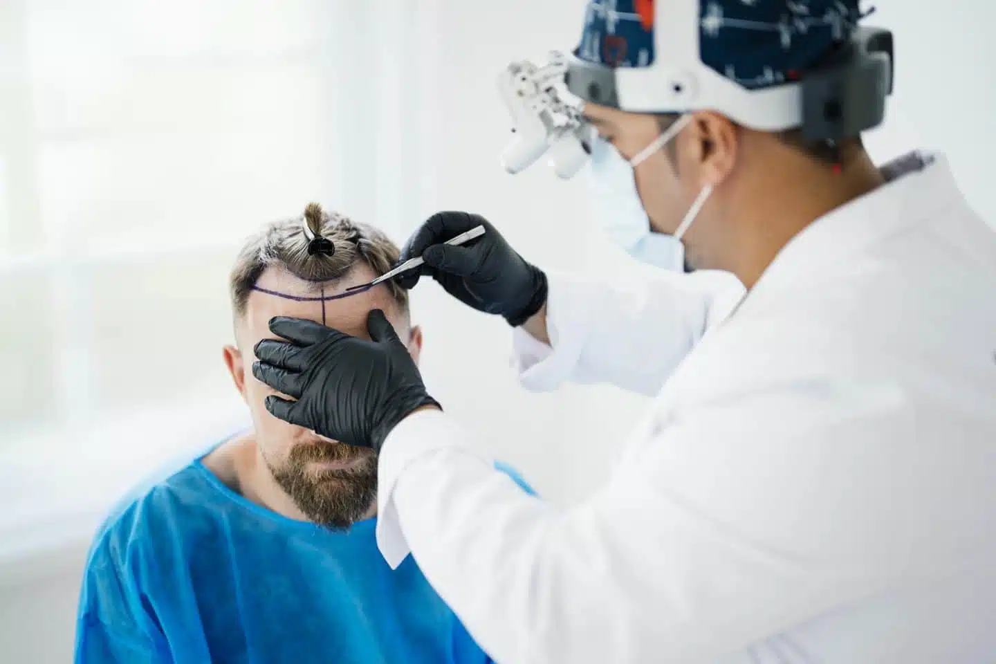 Hair transplant consultation